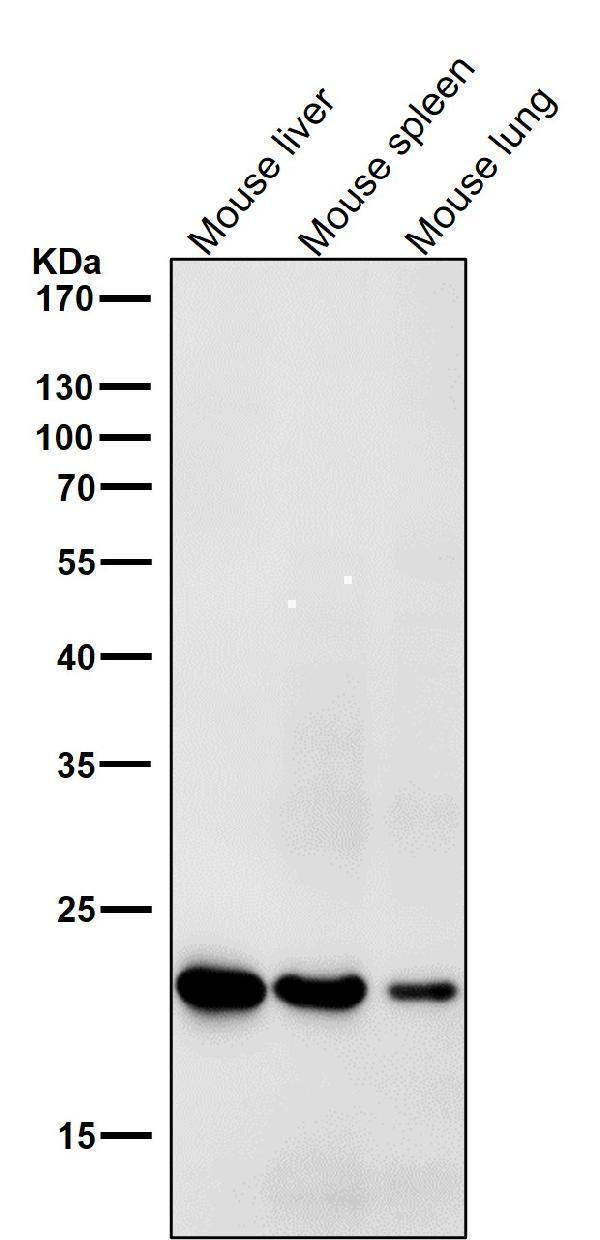 Anti-HE4 WFDC2 Rabbit Monoclonal Antibody Boster Bio