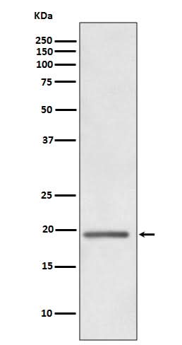 Anti-HE4 WFDC2 Rabbit Monoclonal Antibody Boster Bio