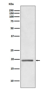 Anti-HE4 WFDC2 Rabbit Monoclonal Antibody Boster Bio