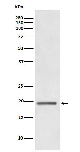 Anti-HE4 WFDC2 Rabbit Monoclonal Antibody Boster Bio
