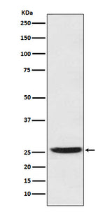 Anti-PGDH Rabbit Monoclonal Antibody Boster Bio