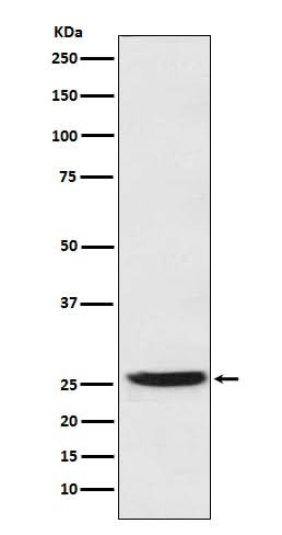 Anti-PGDH Rabbit Monoclonal Antibody Boster Bio