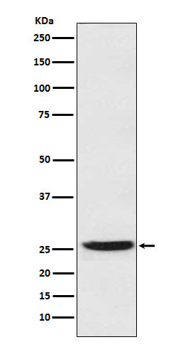 Anti-PGDH Rabbit Monoclonal Antibody Boster Bio