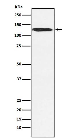 Anti-SNF2H SMARCA5 Monoclonal Antibody Boster Bio