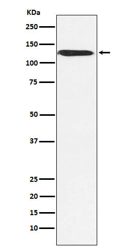 Anti-SNF2H SMARCA5 Monoclonal Antibody Boster Bio