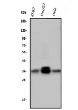 Anti-PPT1 Antibody Picoband® (monoclonal, 10F3 Boster Bio