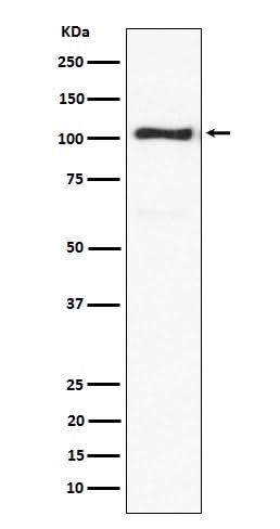 Anti-ACTN3 Rabbit Monoclonal Antibody Boster Bio