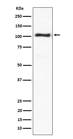 Anti-ACTN3 Rabbit Monoclonal Antibody Boster Bio