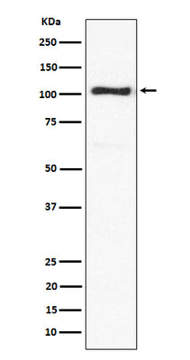 Anti-ACTN3 Rabbit Monoclonal Antibody Boster Bio