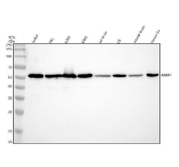 Anti-RbAp48 Rabbit Monoclonal Antibody Boster Bio