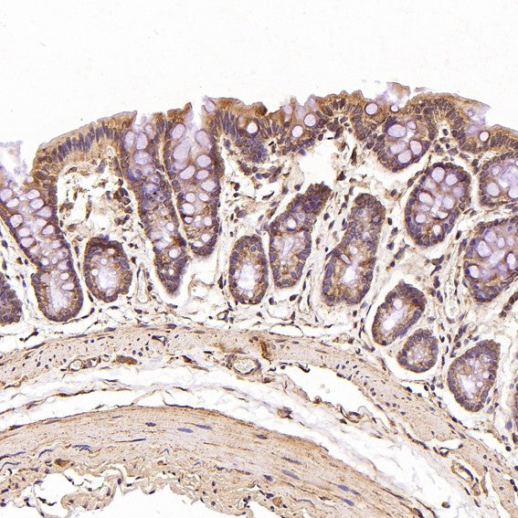 Anti-JNK2 MAPK9 Rabbit Monoclonal Antibody Boster Bio