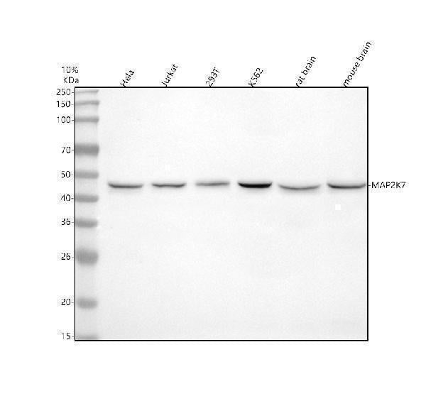Anti-MEK7 MAP2K7 Rabbit Monoclonal Antibody Boster Bio