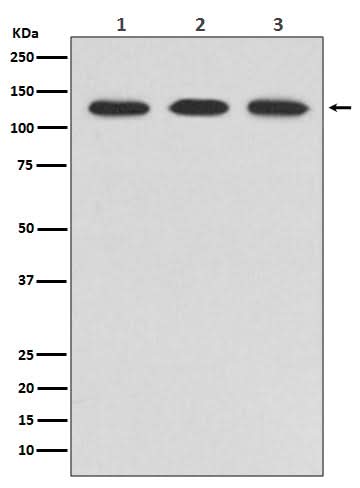 Anti-ABL2 Rabbit Monoclonal Antibody Boster Bio