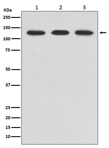 Anti-ABL2 Rabbit Monoclonal Antibody Boster Bio
