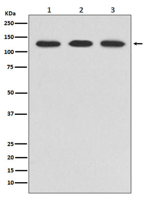 Anti-ABL2 Rabbit Monoclonal Antibody Boster Bio