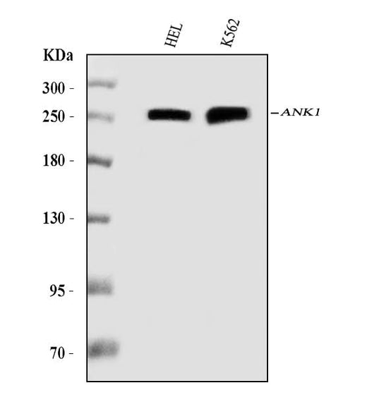 Anti-Ankyrin erythroid/ANK/ANK1 Antibody Picoband® (monoclonal, 5H2E8 Boster Bio