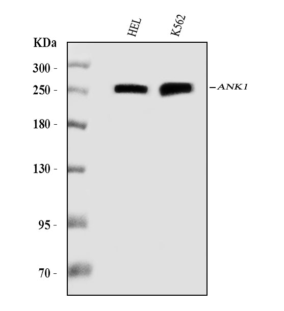 Anti-Ankyrin erythroid/ANK/ANK1 Antibody Picoband® (monoclonal, 5H2E8 Boster Bio