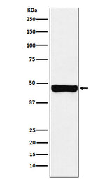 Anti-RCC1 Rabbit Monoclonal Antibody Boster Bio