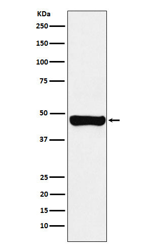 Anti-RCC1 Rabbit Monoclonal Antibody Boster Bio