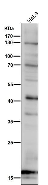 Anti-SDHC Rabbit Monoclonal Antibody Boster Bio