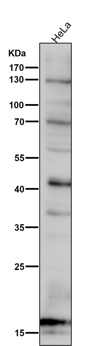 Anti-SDHC Rabbit Monoclonal Antibody Boster Bio