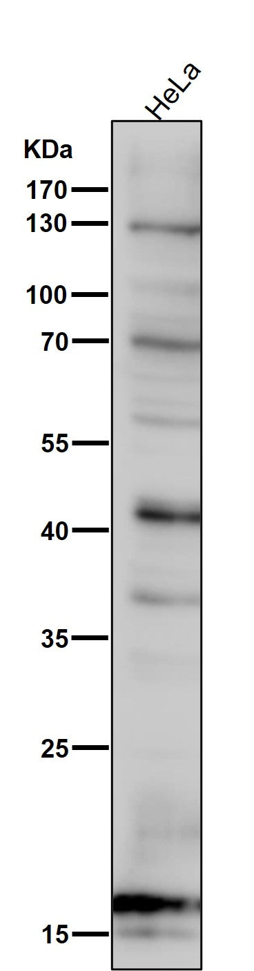 Anti-SDHC Rabbit Monoclonal Antibody Boster Bio