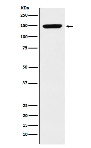 Anti-p150 CAF1 Rabbit Monoclonal Antibody Boster Bio