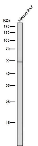Anti-ACM2 Rabbit Monoclonal Antibody Boster Bio