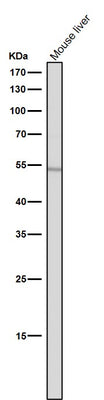 Anti-ACM2 Rabbit Monoclonal Antibody Boster Bio