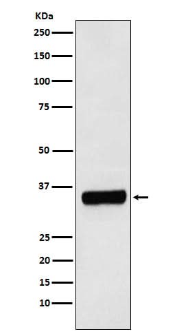 Anti-PRKRA Rabbit Monoclonal Antibody Boster Bio