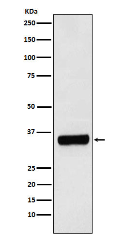 Anti-PRKRA Rabbit Monoclonal Antibody Boster Bio
