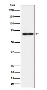 Anti-NR2C2 / TR4 Rabbit Monoclonal Antibody Boster Bio
