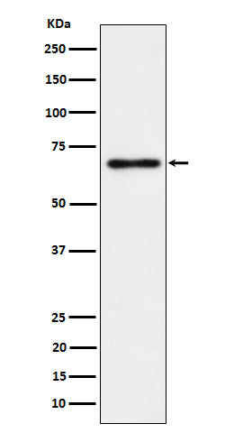 Anti-NR2C2 / TR4 Rabbit Monoclonal Antibody Boster Bio