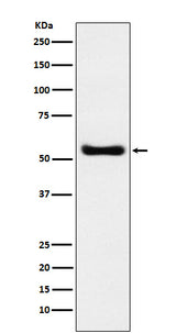 Anti-KAT8 / MYST1 / MOF Rabbit Monoclonal Antibody Boster Bio