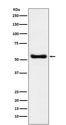 Anti-KAT8 / MYST1 / MOF Rabbit Monoclonal Antibody Boster Bio