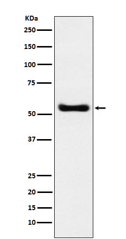 Anti-KAT8 / MYST1 / MOF Rabbit Monoclonal Antibody Boster Bio