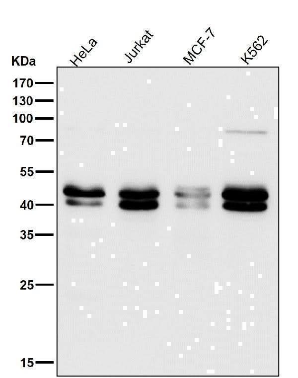 Anti-TIA1 Rabbit Monoclonal Antibody Boster Bio