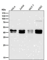 Anti-TIA1 Rabbit Monoclonal Antibody Boster Bio