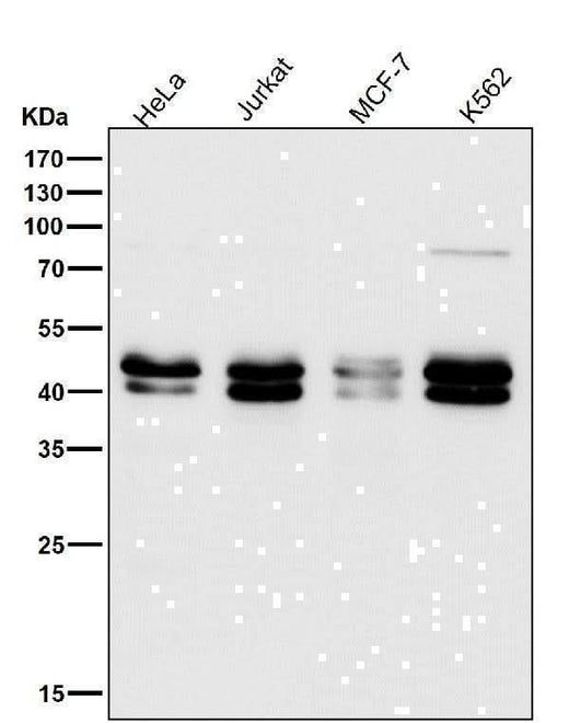 Anti-TIA1 Rabbit Monoclonal Antibody Boster Bio