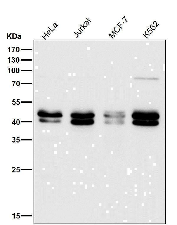 Anti-TIA1 Rabbit Monoclonal Antibody Boster Bio