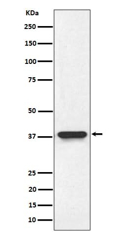 Anti-NMI Rabbit Monoclonal Antibody Boster Bio