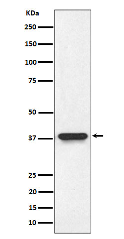 Anti-NMI Rabbit Monoclonal Antibody Boster Bio