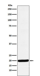 Anti-Y14 Rabbit Monoclonal Antibody Boster Bio