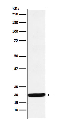Anti-Y14 Rabbit Monoclonal Antibody Boster Bio
