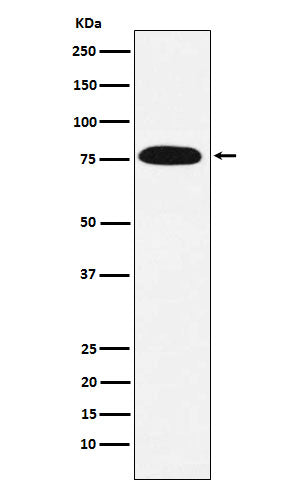 Anti-KHSRP Rabbit Monoclonal Antibody Boster Bio