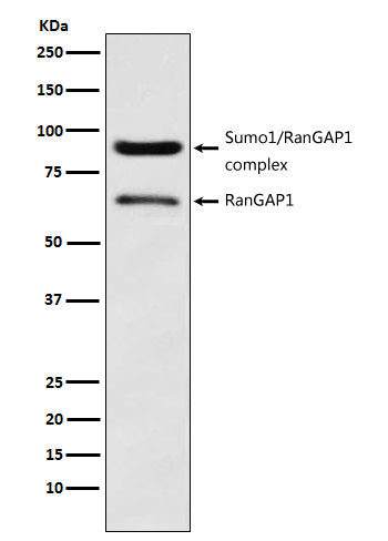 Anti-RanGAP1 Rabbit Monoclonal Antibody Boster Bio