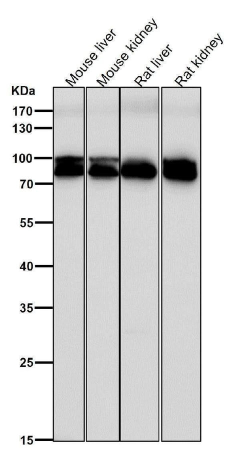 Anti-Aconitase 1 ACO1 Rabbit Monoclonal Antibody Boster Bio