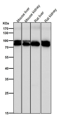 Anti-Aconitase 1 ACO1 Rabbit Monoclonal Antibody Boster Bio