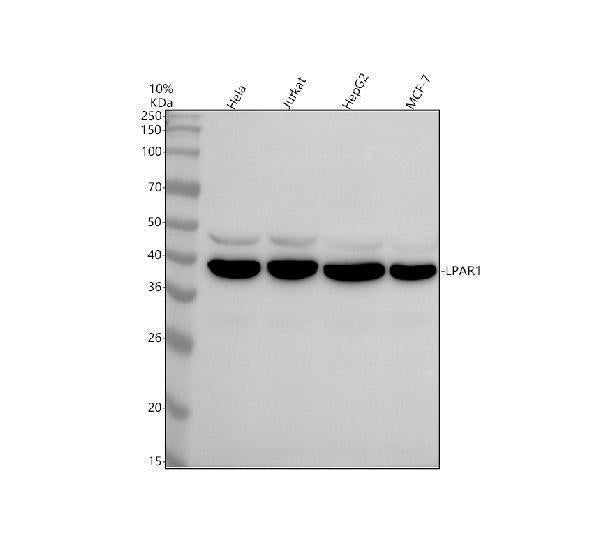 Anti-EDG2 LPAR1 Rabbit Monoclonal Antibody Boster Bio