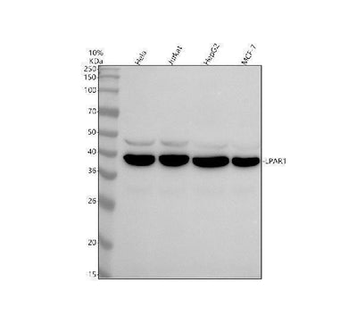 Anti-EDG2 LPAR1 Rabbit Monoclonal Antibody Boster Bio